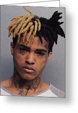 casey moriggi recommends xxxtentacion nudes pic