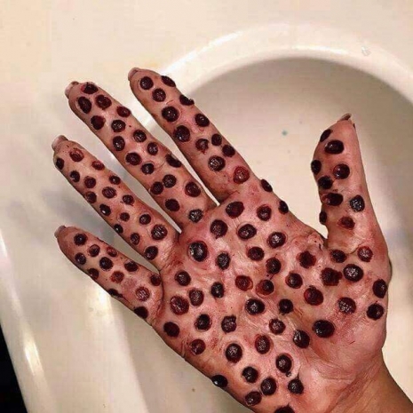 aastha bakshi share trypophobia porn photos