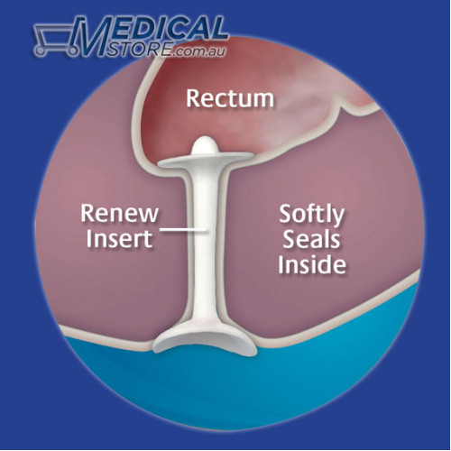 brian biglin recommends anal inserion pic