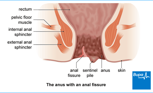 claudette butler recommends anal pain face pic