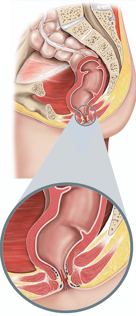 dorothy neethling recommends anal pain face pic