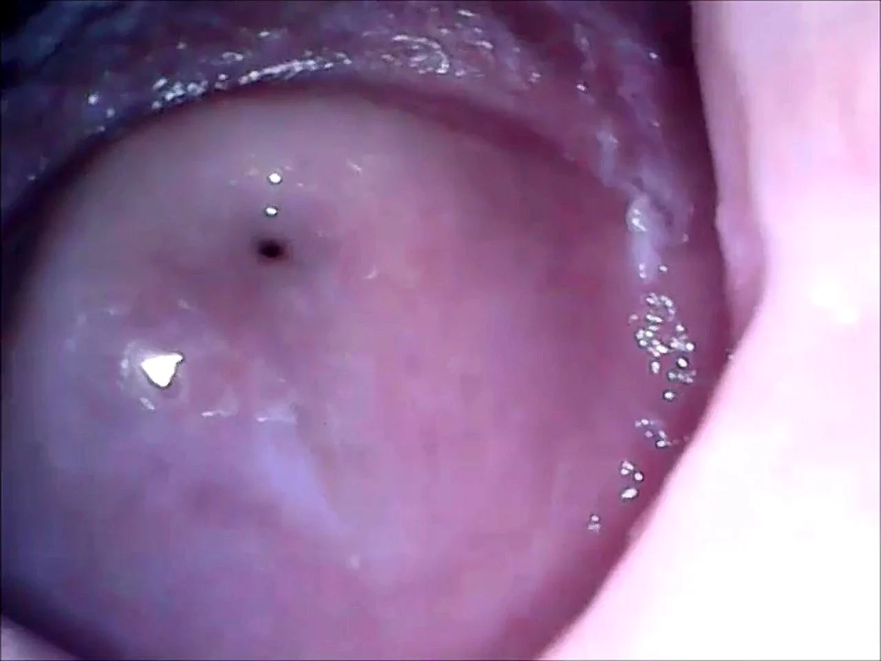 Best of Internal vagina camera