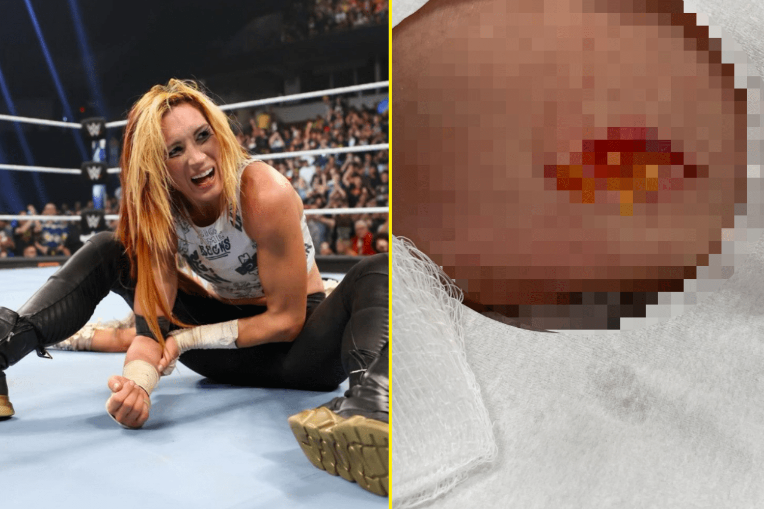 Becky Lynch Leaked knoxville tennessee