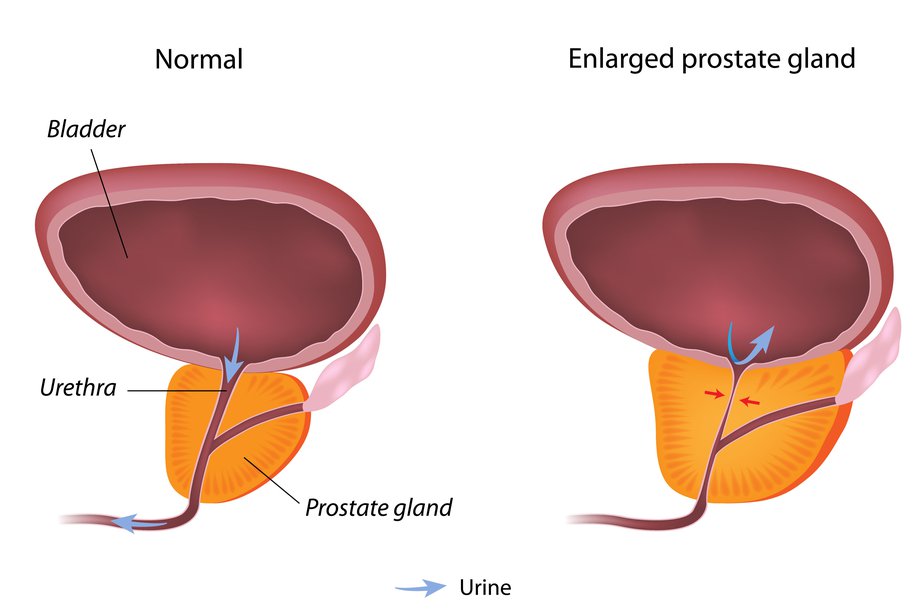 nut inside